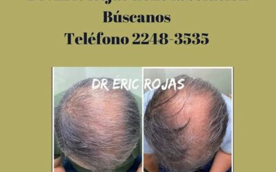 Excelentes resultados
