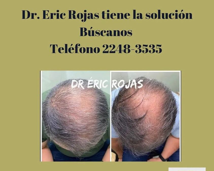 Excelentes resultados