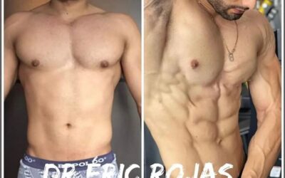 Vos tambien podés lucir una figura Slím Láser