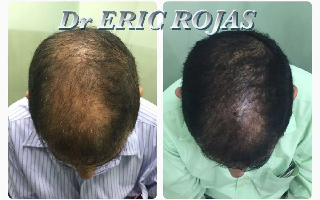 Tenemos la solución