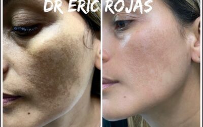 Manchas en la CARA DR ÉRIC ROJAS 22483535