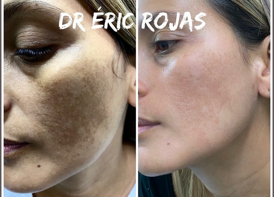 Manchas en la CARA DR ÉRIC ROJAS 22483535