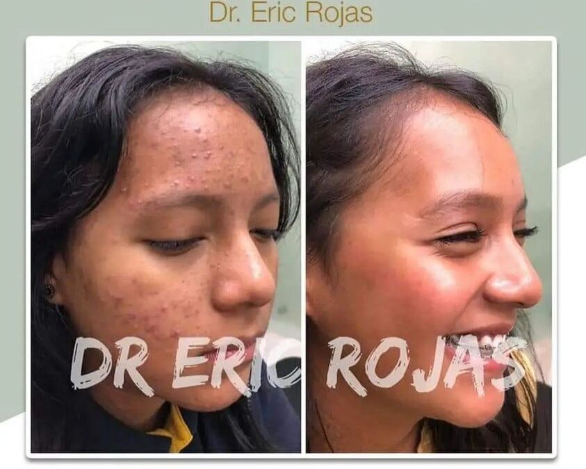 Tenemos la solución