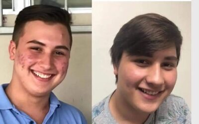 Resultados reales