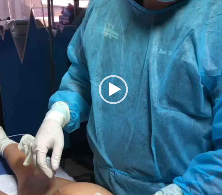 Preparate para el verano mejorando Tu Figura.