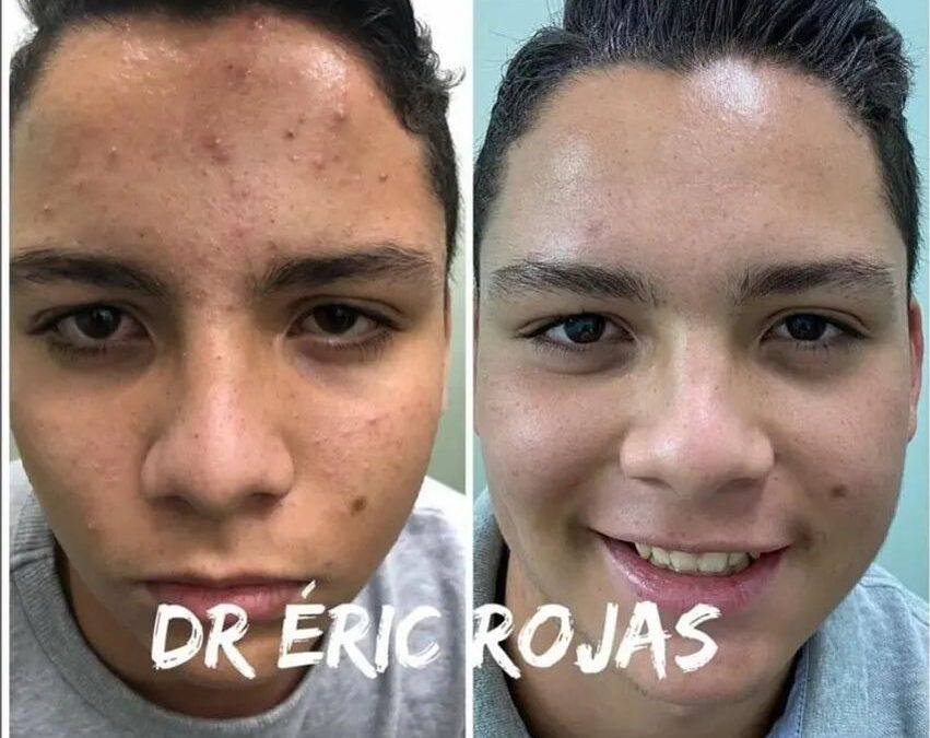 Tenemos la solución