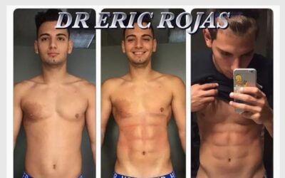 Slim láser con excelentes resultados