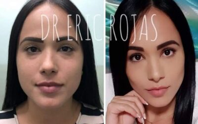 Perfilado facial