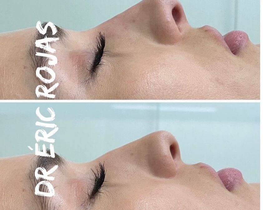 PERFILADO DE NARIZ EN MENOS DE 10 minutos