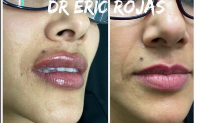 Dr. Eric Rojas
