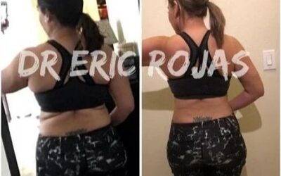 Increíbles resultados Slim Láser