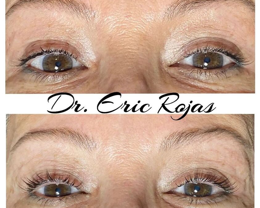 Lifting de pestañas