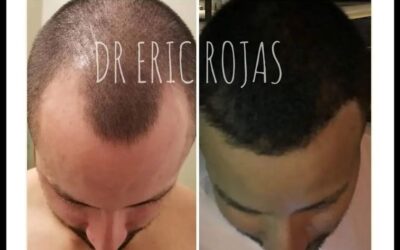 Tenemos la solución