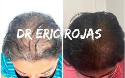 Sufre se caída de cabello