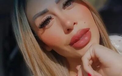 @dianamonterooficial cuida su rostro con el Dr Eric Rojas