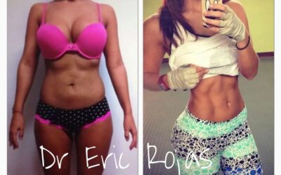 Abdomen Slim Láser