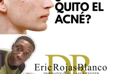 Sin ninguna pena para salir de casa, somos el centro especializado contra el acné mas preparado en Costa Rica.