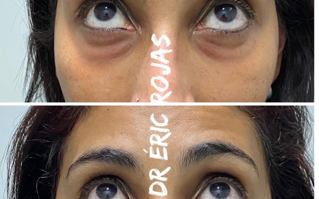 MEJORA TUS OJERAS DR ÉRIC ROJAS 22483535