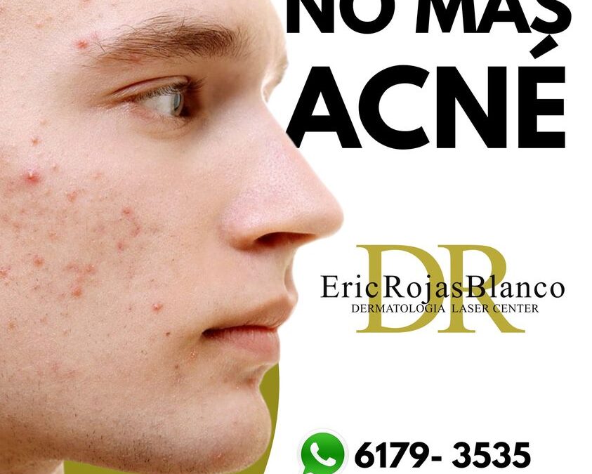 Sin ninguna pena para salir de casa