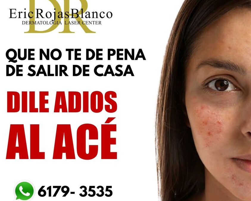 Sin ninguna pena para salir de casa