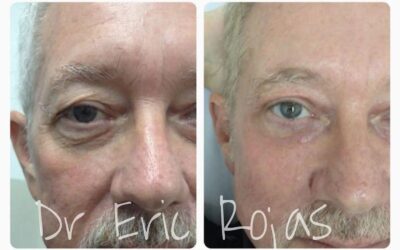 Eliminar sus ojeras y lucir una mirada fresca es posible ¡Agenda tu cita ya!  ☎️ 2248-3535  📲 6405-3535