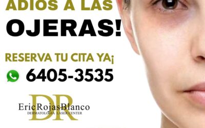 Eliminar sus ojeras y lucir una mirada fresca es posible