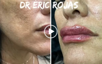 Modelado de labios