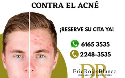 Sin ninguna pena para salir de casa, somos el centro especializado contra el acné mas preparado en Costa Rica.