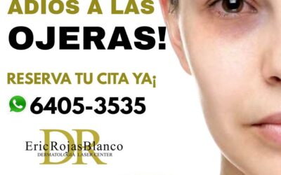 Eliminar sus ojeras y lucir una mirada fresca es posible
