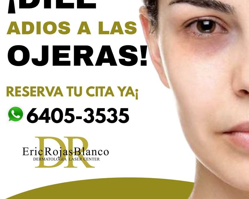 Eliminar sus ojeras y lucir una mirada fresca es posible