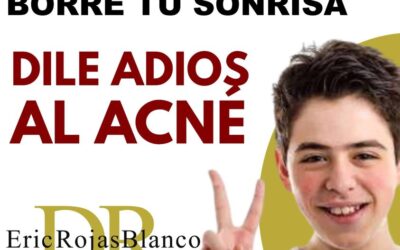 Sin ninguna pena para salir de casa, somos el centro especializado contra el acné mas preparado en Costa Rica.