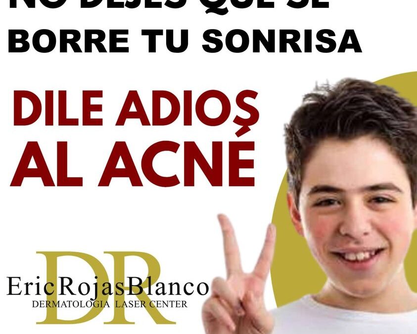 Sin ninguna pena para salir de casa, somos el centro especializado contra el acné mas preparado en Costa Rica.