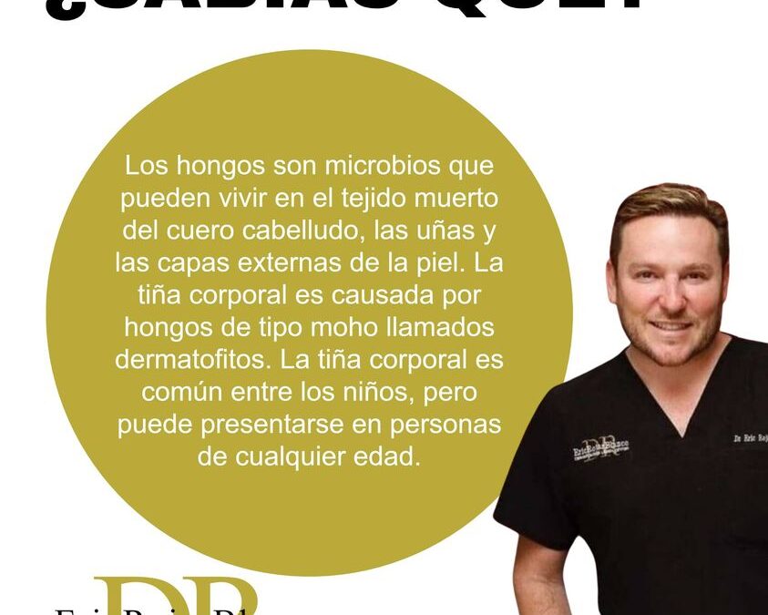¿HONGOS EN LA PIEL?