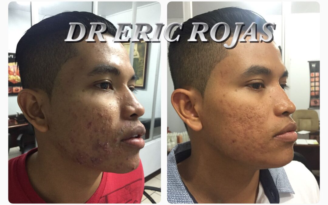 Los buenos resultados hablan por nosotros.