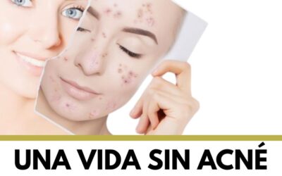 Sin ninguna pena para salir de casa, somos el centro especializado contra el acné mas preparado en Costa Rica.