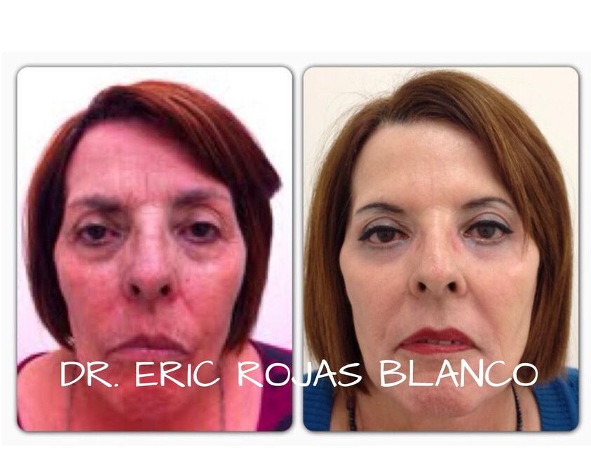 Los buenos resultados hablan por nosotros.