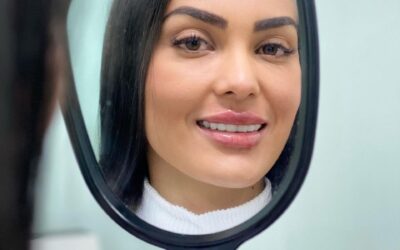MODELADO DE LABIOS DR ÉRIC ROJAS 22483535