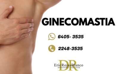 La ginecomastia