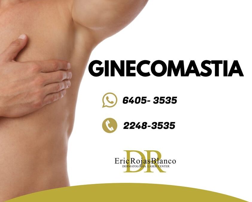 La ginecomastia