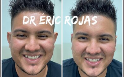 OTODERMOPLASTIA DR ÉRIC ROJAS 22483535