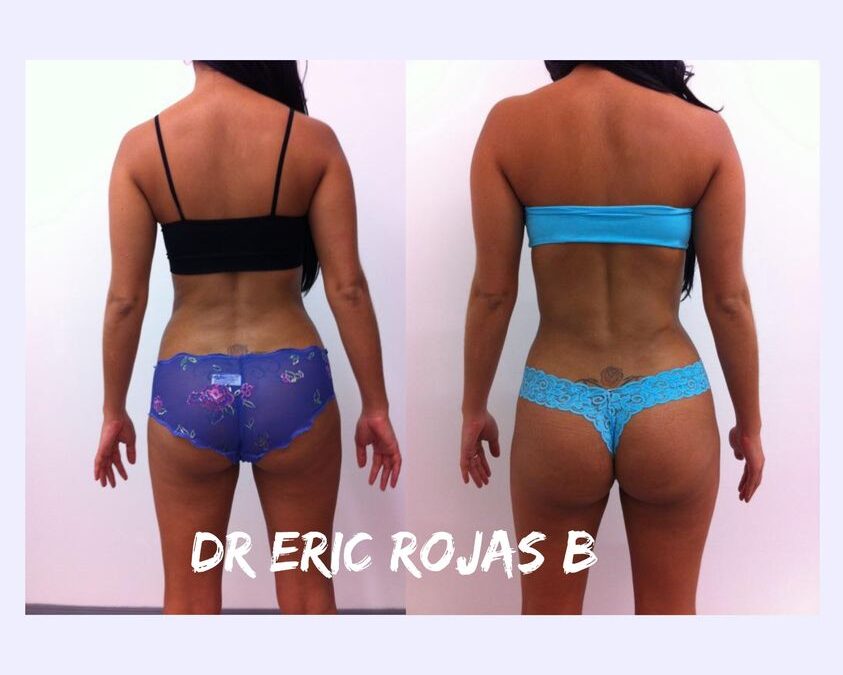 LUCE RADIANTE ESTE VERANO