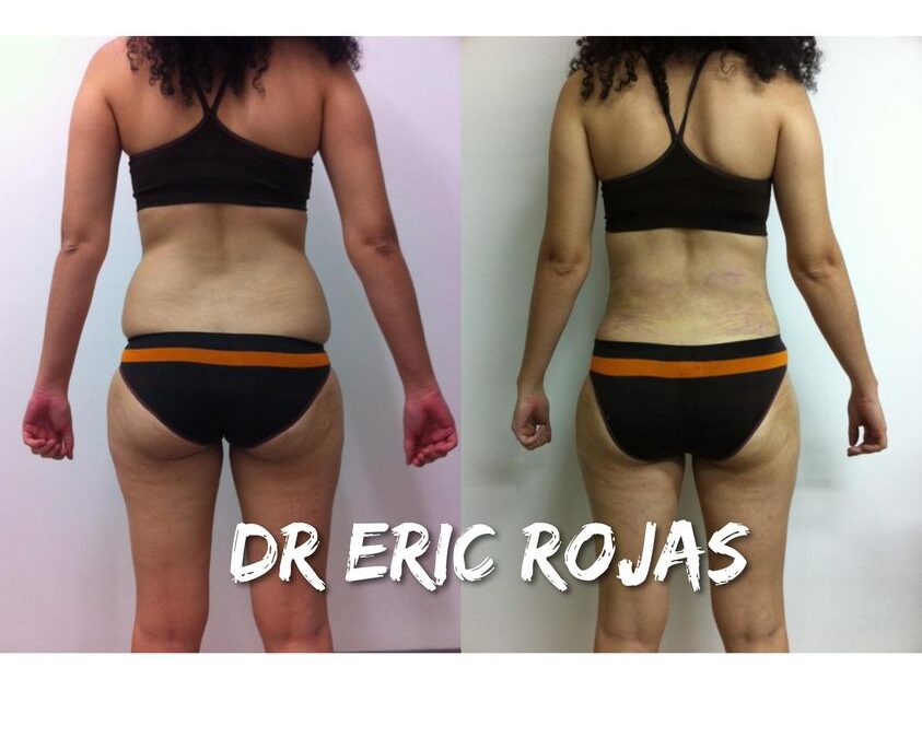 LUCE RADIANTE ESTE VERANO