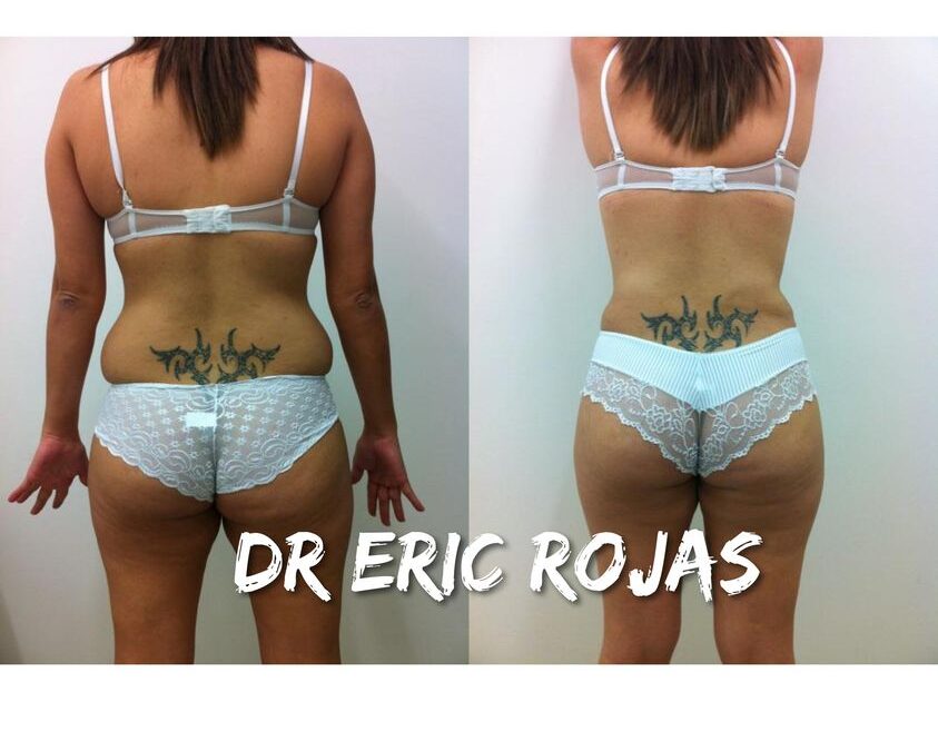 LUCE RADIANTE ESTE VERANO