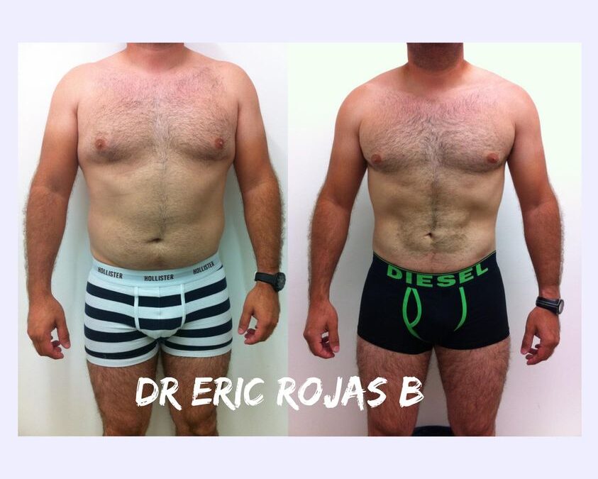 LUCE RADIANTE ESTE VERANO