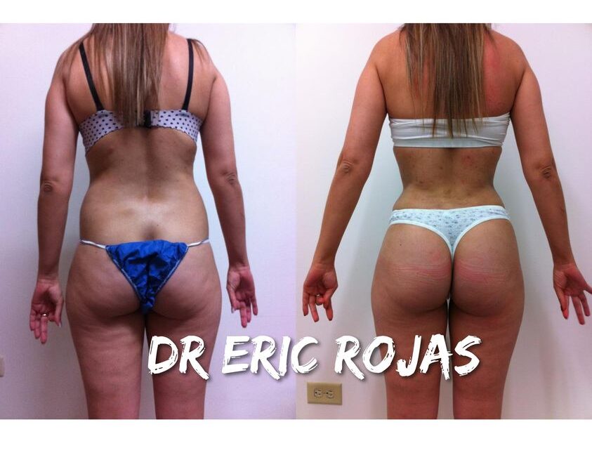 LUCE RADIANTE ESTE VERANO