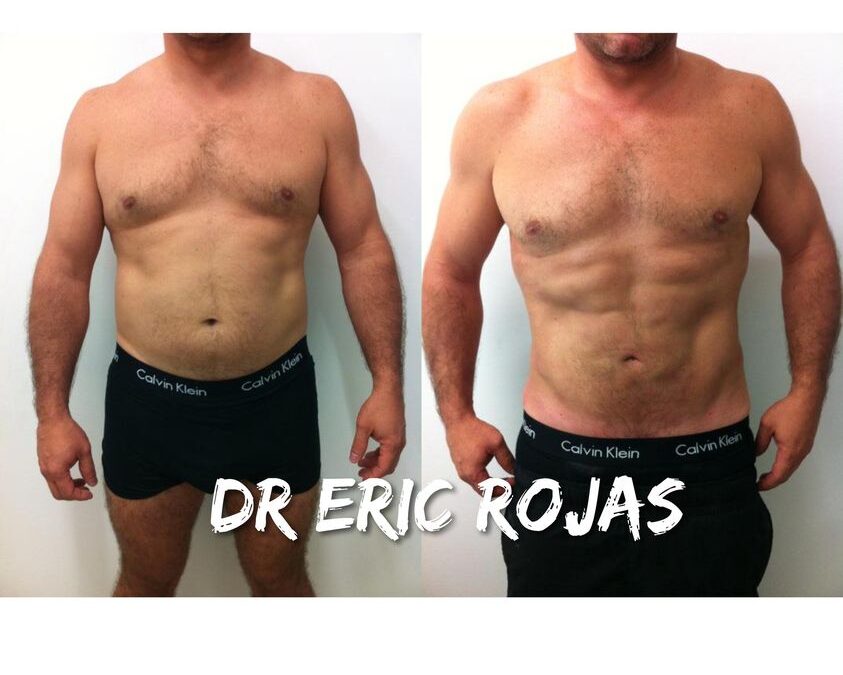 LUCE RADIANTE ESTE VERANO