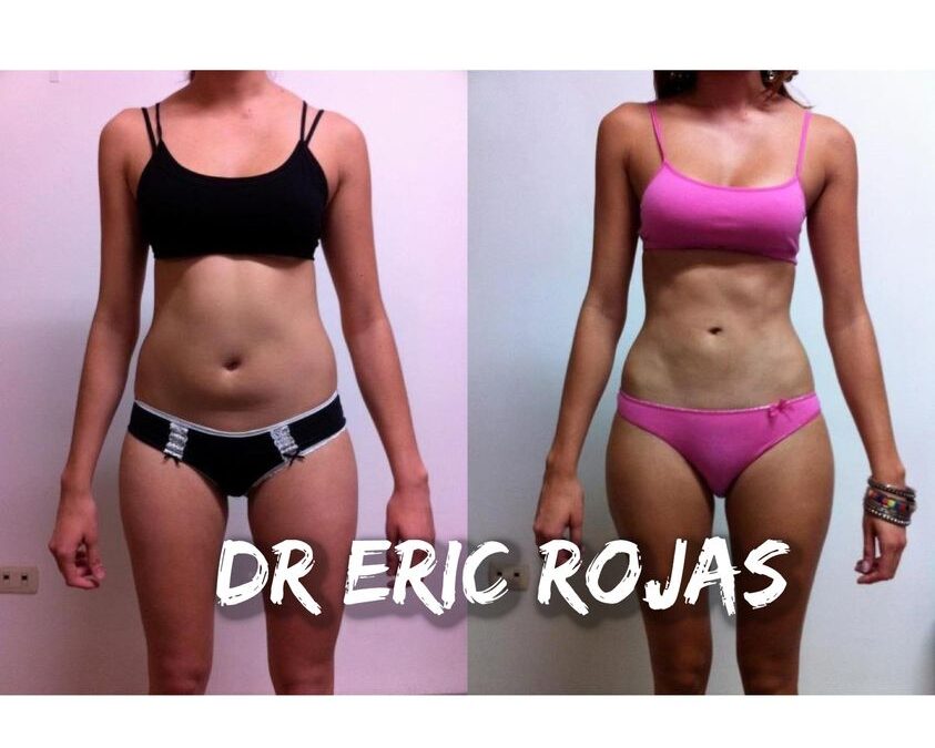 LUCE RADIANTE ESTE VERANO