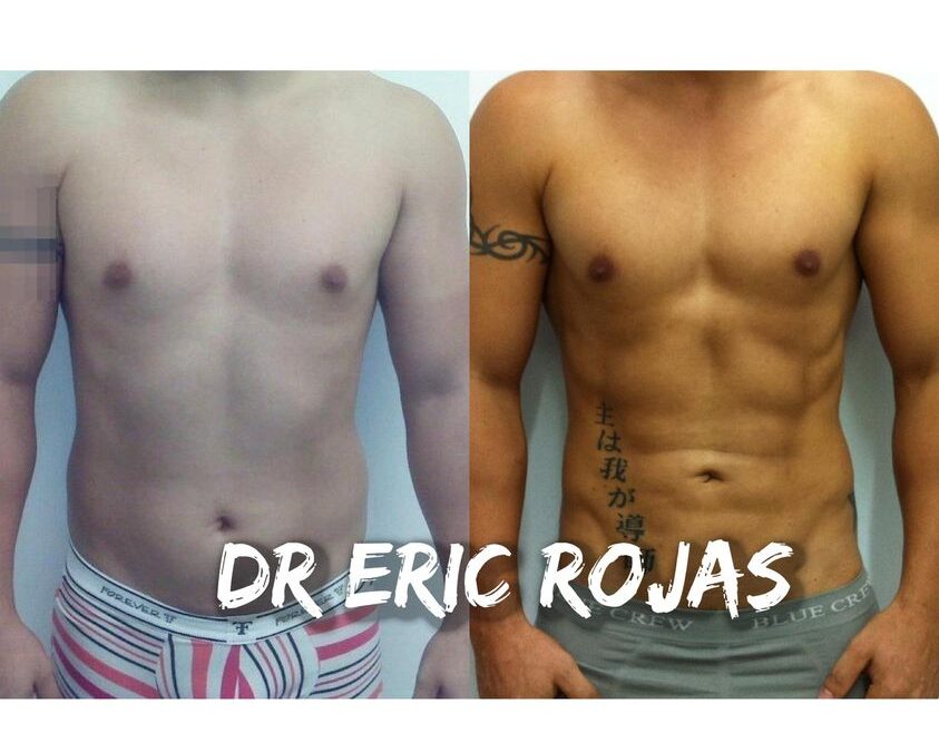 LUCE RADIANTE ESTE VERANO