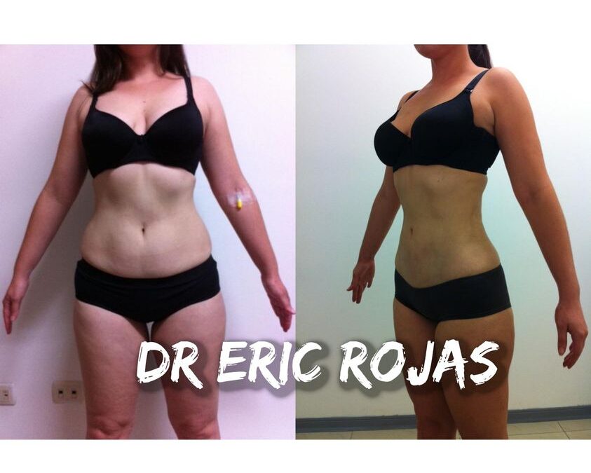 LUCE RADIANTE ESTE VERANO