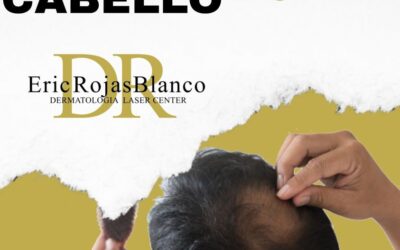 La caída del cabello es uno de los principales motivos de consulta dermatológica.